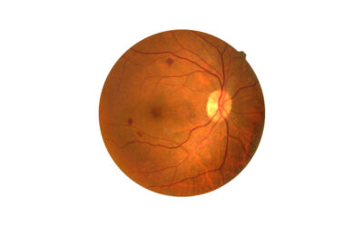 Πέμπτη 14 Νοεμβρίου 2019 Παγκόσμια Ημέρα Σακχαρώδη Διαβήτη