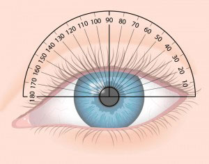 astigmatismos 3 georgios lamprakis xeirourgos ofthalmiatros ioannina