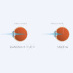 myopia